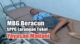 Korban keracunan MBG saat menjalani perawatan di rumah sakit.