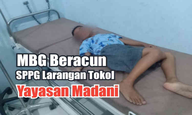 Korban keracunan MBG saat menjalani perawatan di rumah sakit.
